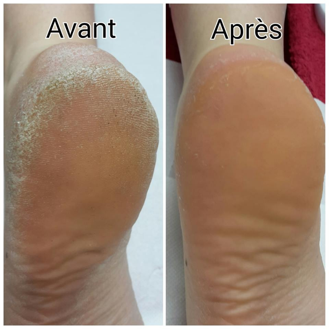 Crème pour les pieds Max lady à la vitamine C كريم ماكس ليدي للقدمين بفيتامين